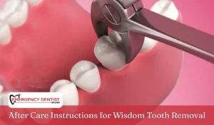 After Care Instructions for Wisdom Tooth Removal
