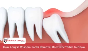 How Long is Wisdom Tooth Removal Recovery What to Know