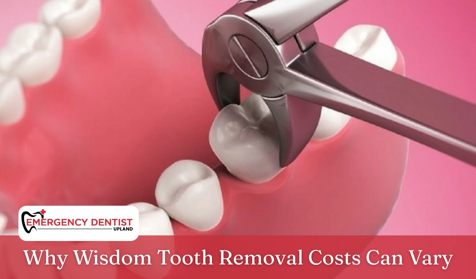 Why Wisdom Tooth Removal Costs Can Vary