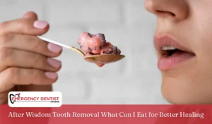 After Wisdom Tooth Removal What Can I Eat for Better Healing