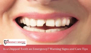 Is a Chipped Tooth an Emergency Warning Signs and Care Tips