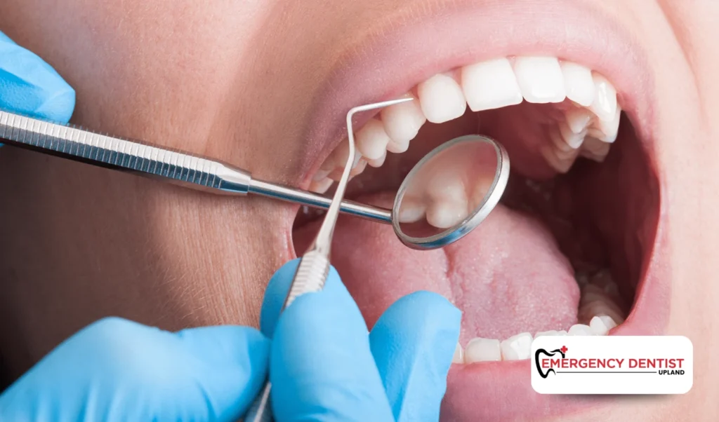 Is a Small Chipped Tooth an Emergency