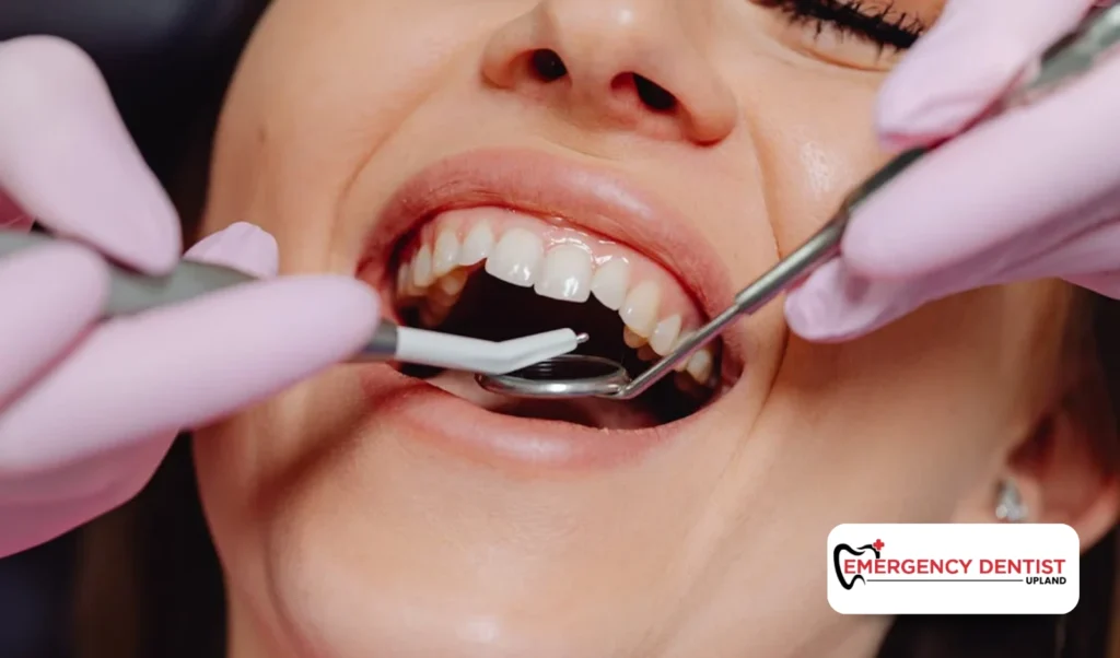 Professional Treatment Options for Repairing a Chipped Tooth