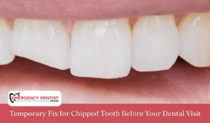 Temporary Fix for Chipped Tooth Before Your Dental Visit
