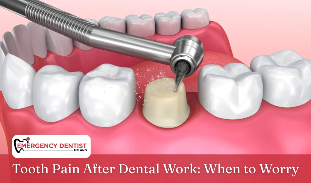 Tooth Pain After Dental Work When to Worry
