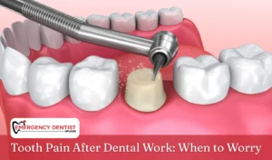 Tooth Pain After Dental Work When to Worry