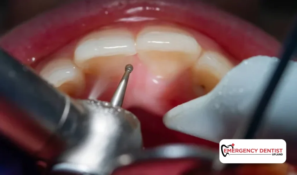 Tooth Pain After Filling: Normal Sensitivity or Concern?