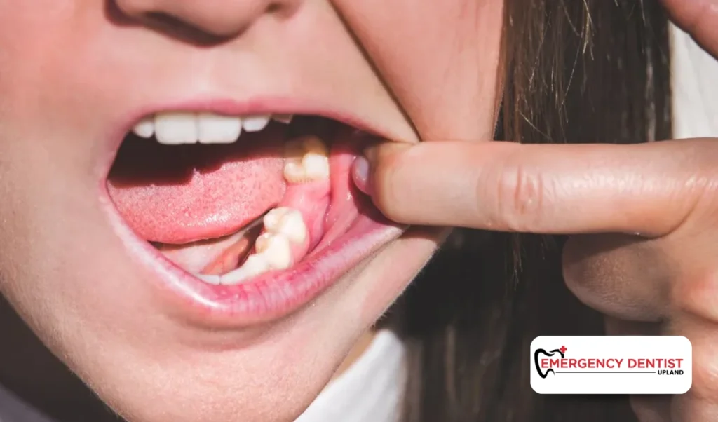 Tooth Pain After Tooth Pulled: Healing vs. Complication