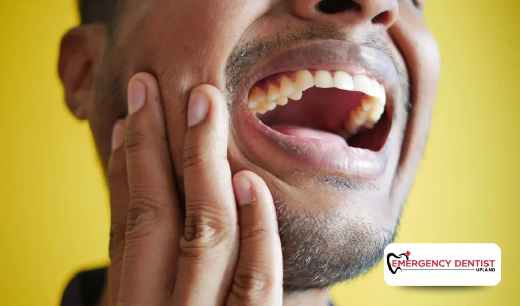 When to See an Emergency Dentist in Upland