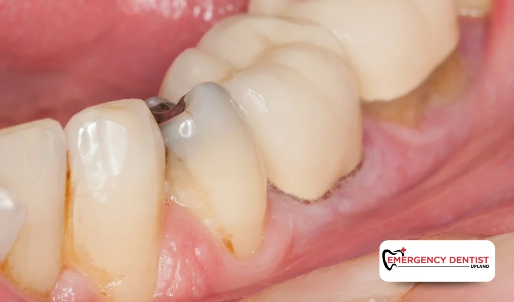 What Causes Tooth Pain