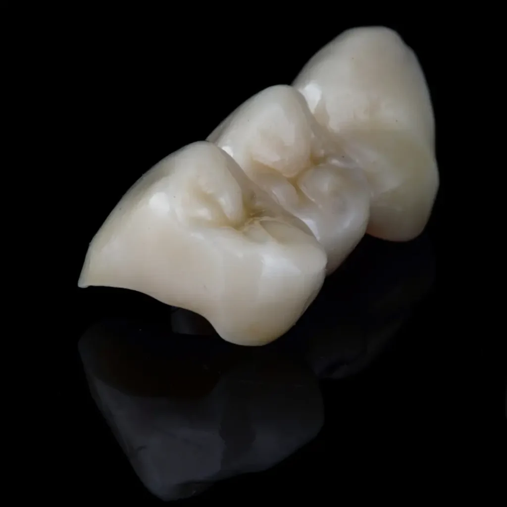 Broken-or-cracked-dental-bridge-Upland-CA