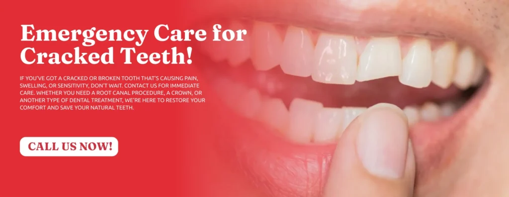 Cracked-Tooth-Repair-Upland-CA