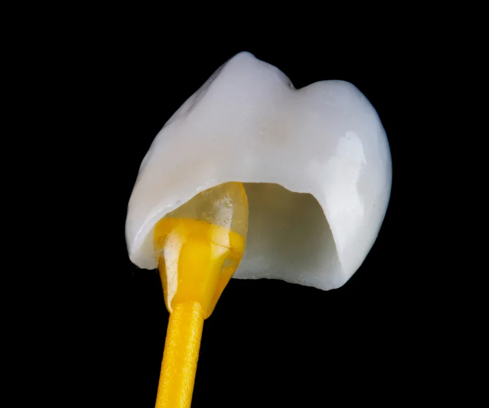 Dental-Crowns-Upland-CA