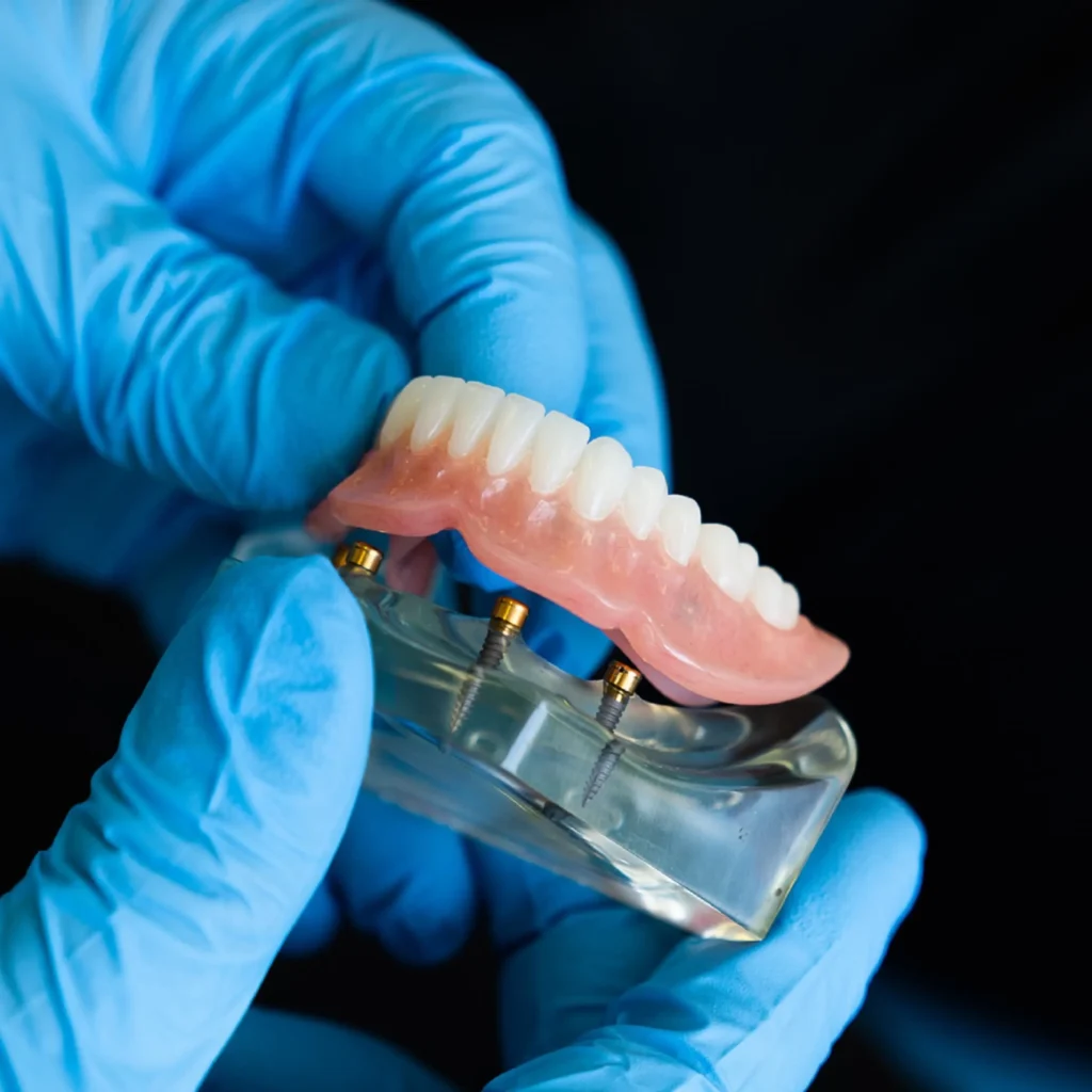 Emergency-Dentures-Repair-in-Upland-CA