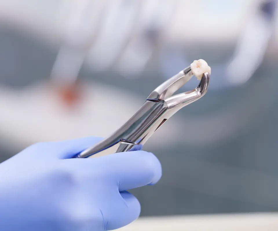 Emergency-Extraction-Upland-CA