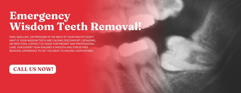 Emergency-Wisdom-Tooth-Removal-in-Upland-CA