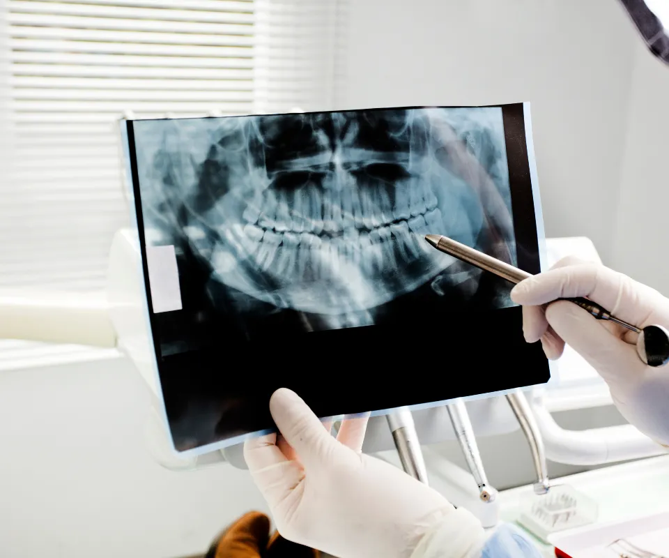 Emergency-dental-X-rays-Upland-CA