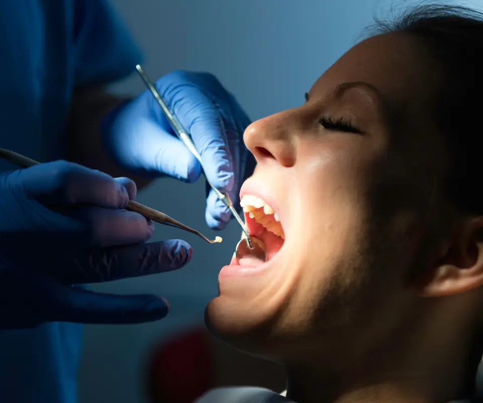 Lost-Fillings-or-Crowns-Upland-CA