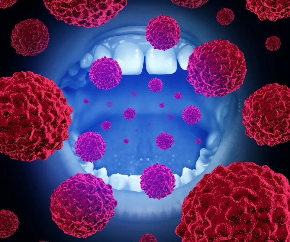 Oral-Cancer-Upland-CA