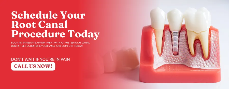 Root-Canal-Therapy-in-Upland-CA