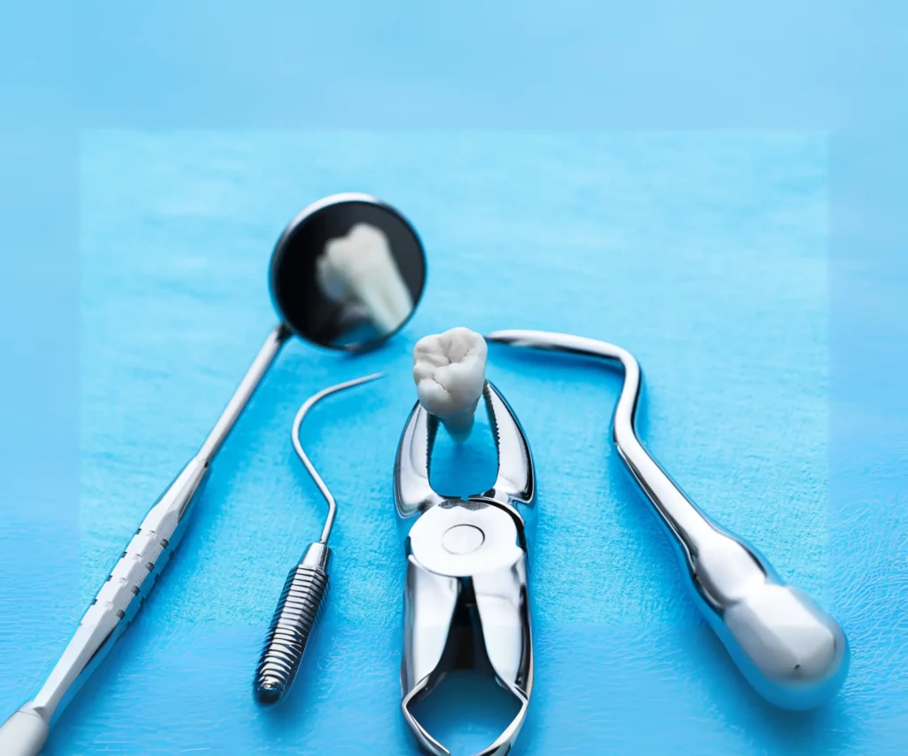 Simple-Tooth-Extractions-Upland-CA