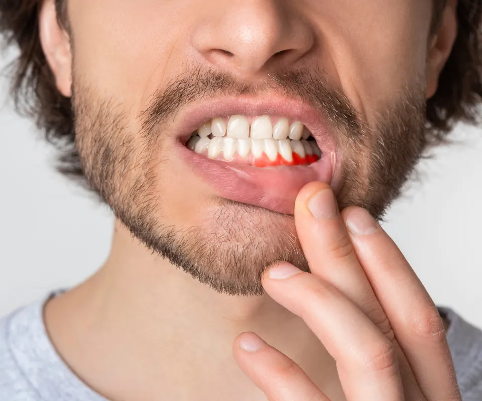 When-to-See-an-Emergency-Dentist-for-a-Tooth-Infection-Upland-CA
