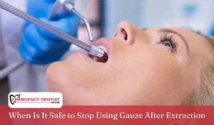 when-to-stop-using-gauze-after-extraction