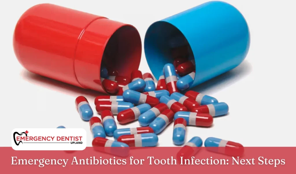 emergency-antibiotics-tooth-infection-next-steps