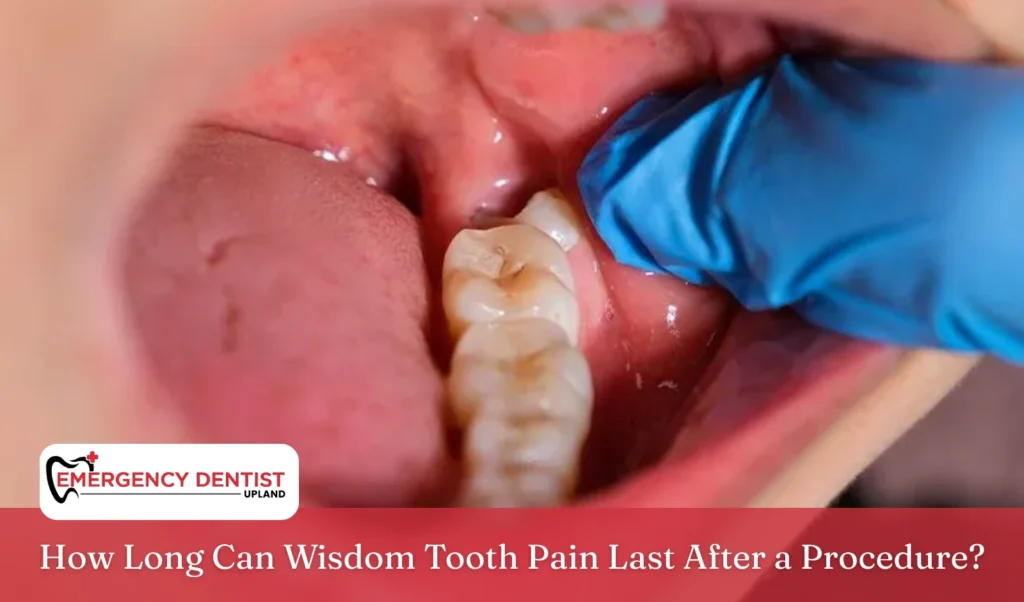 how-long-wisdom-tooth-pain-lasts-after-procedure