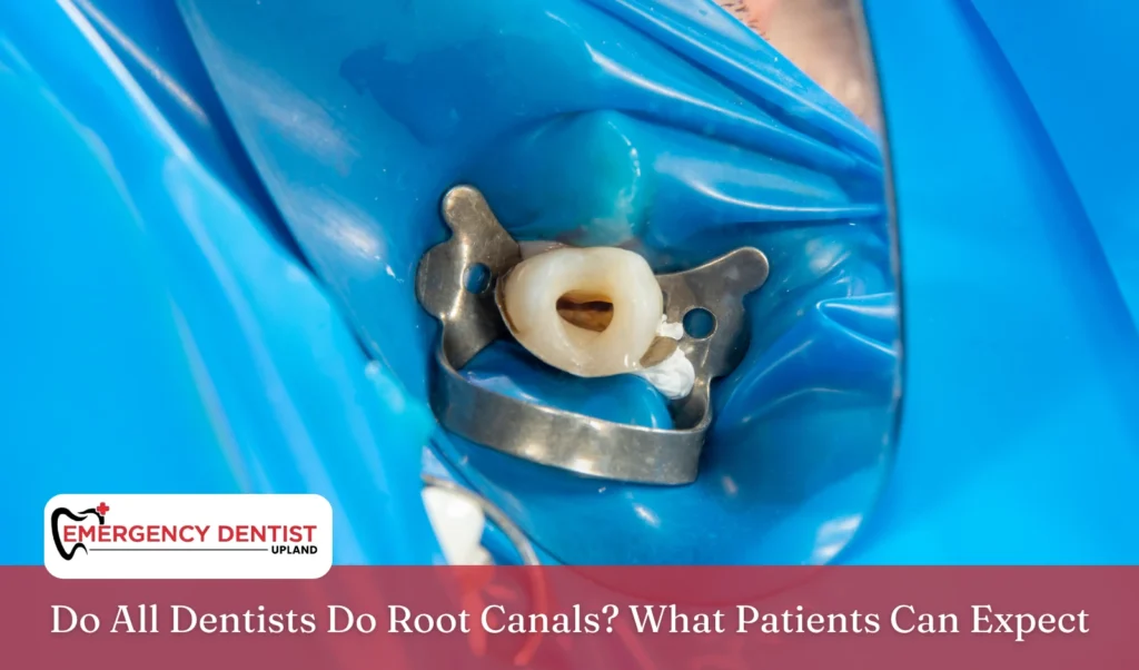 do-all-dentists-do-root-canals