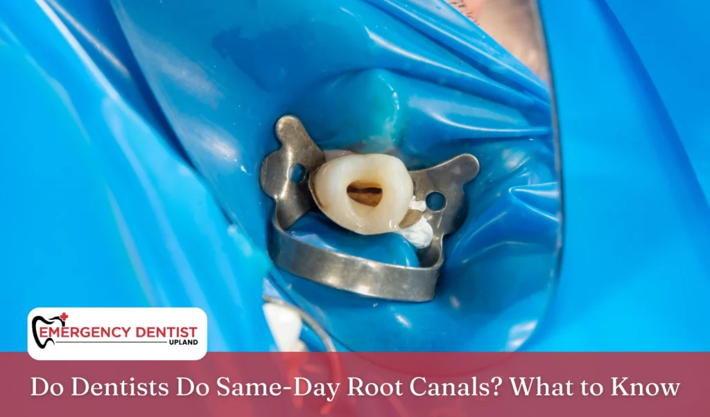 do-dentists-do-same-day-root-canals