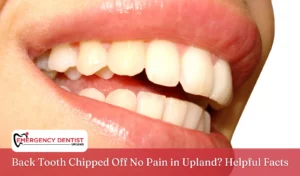 Back Tooth Chipped Off No Pain in Upland Helpful Facts